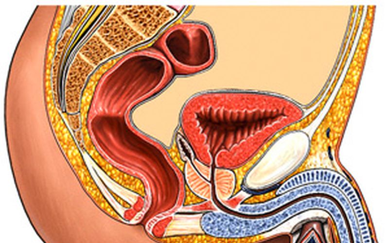 He tratado la prostatitis crónica. He tratado la prostatitis crónica.